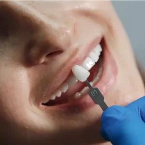 Single Tooth Replacement in Connecticut