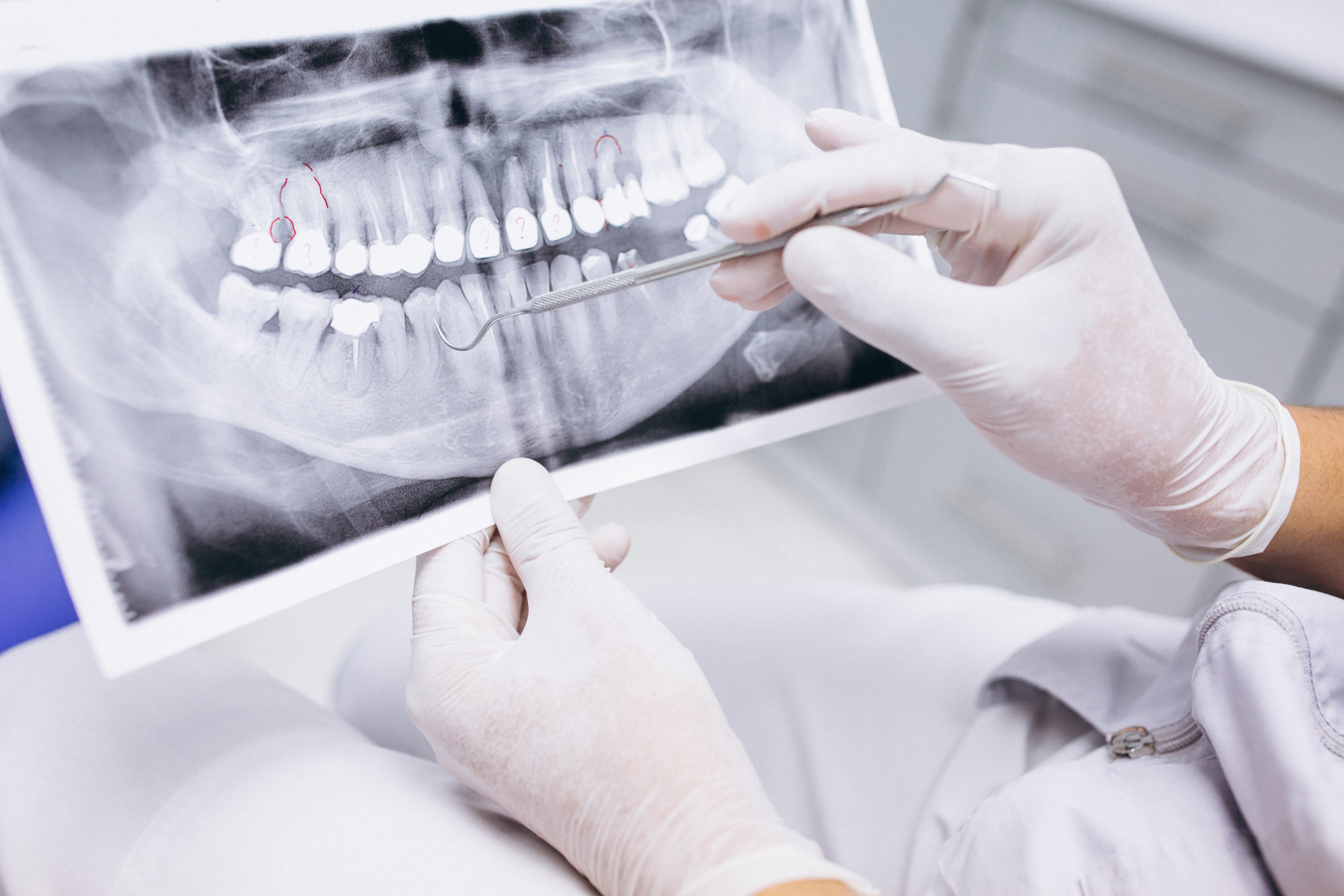 X-ray | New Patients - Smile Center