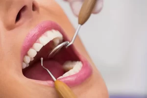 Cleaning and prevention - Dental Services