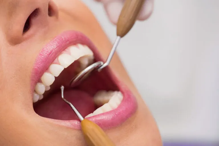 Cleaning and prevention - Dental Services